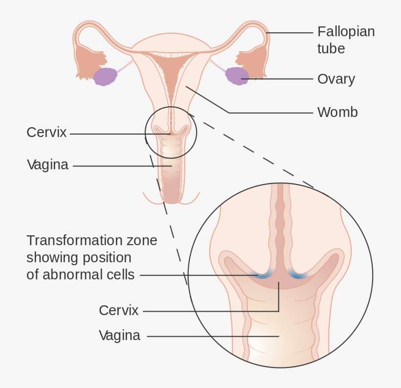 Cervical Cancer - Cervix Anatomy Transitional Zone, transparent png download