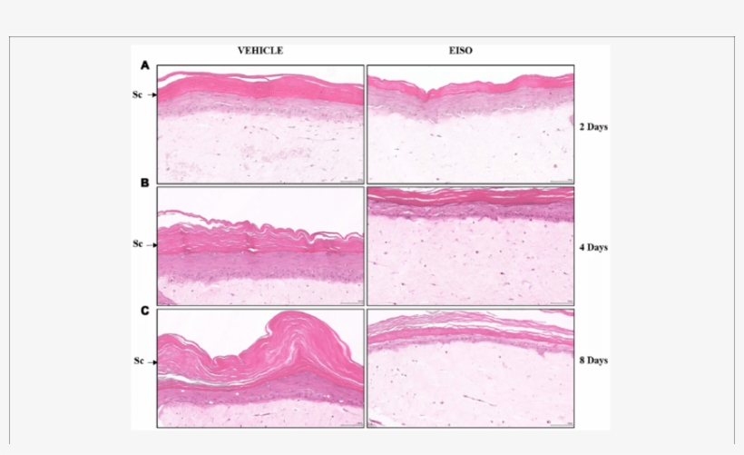 East Indian Sandalwood Oil Treatment Restores Epidermal - Illustration, transparent png download