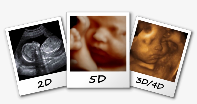 3d/4d/5d Ultrasound Fayetteville Nc Comparison Image - 3d 4d 5d Ultrasound, transparent png download