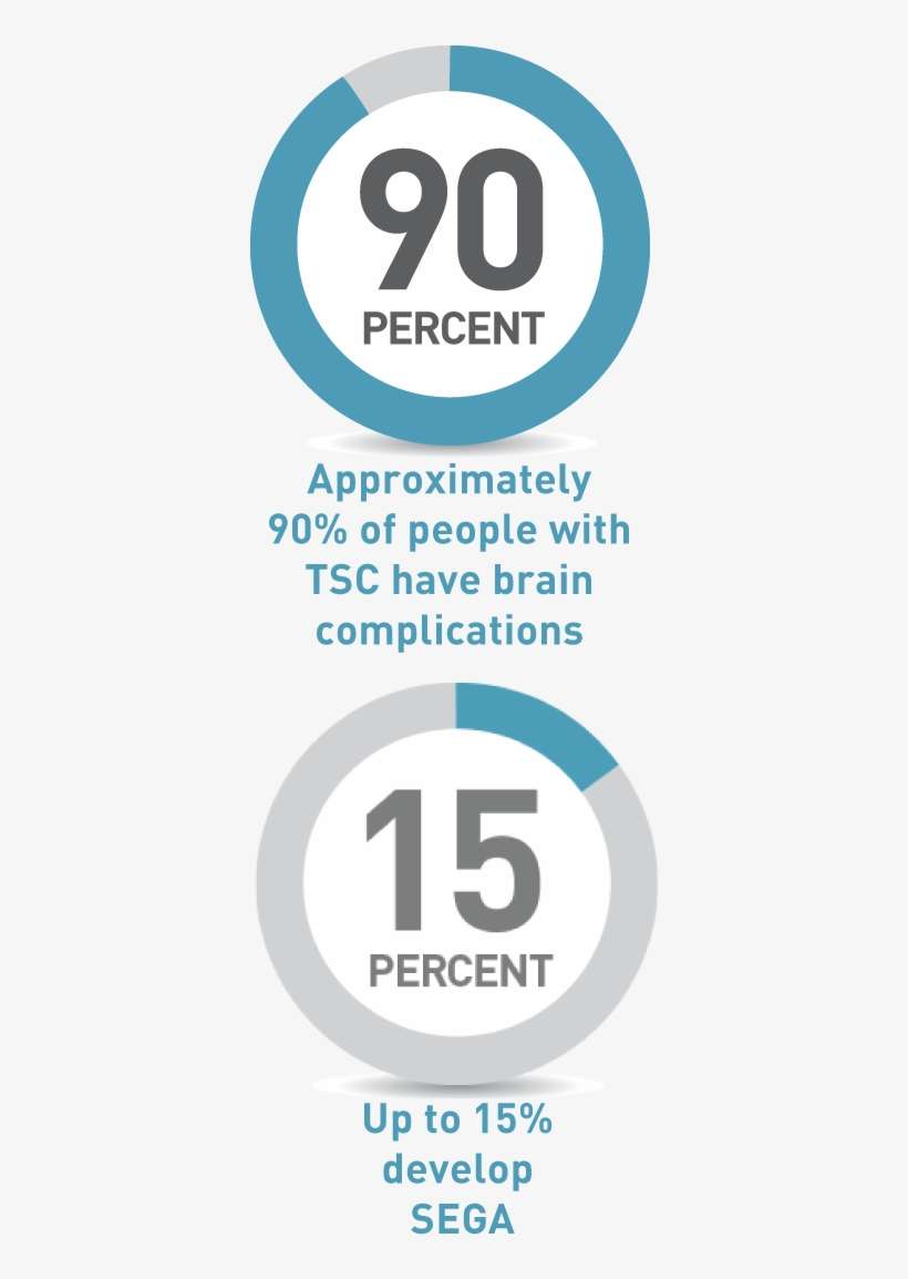 Segas Usually Develop During Childhood But They Can - Accent Jobs, transparent png download