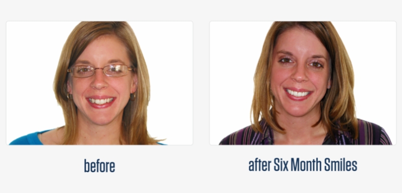 Gallery-16 - Girl, transparent png download