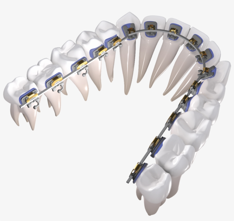 Control From Start To Finish - Bead, transparent png download