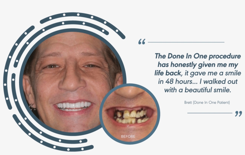 34265946 0 Testimonial Brett 3 - Dental Braces, transparent png download