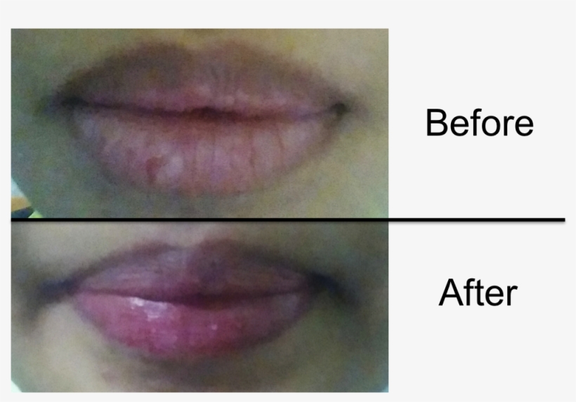 In The After Picture, The Dark Outline Of The Lips - Lip Gloss, transparent png download
