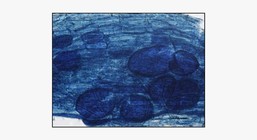 Vesicles In The Roots Of “vanda” Sweet Cherry Trees - Root Staining Fungal Pathogens, transparent png download