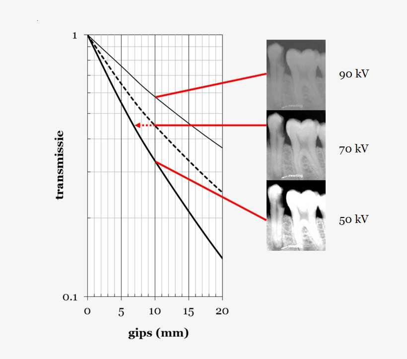 Transmission Through Plaster For Different Values Of - Groningen, transparent png download
