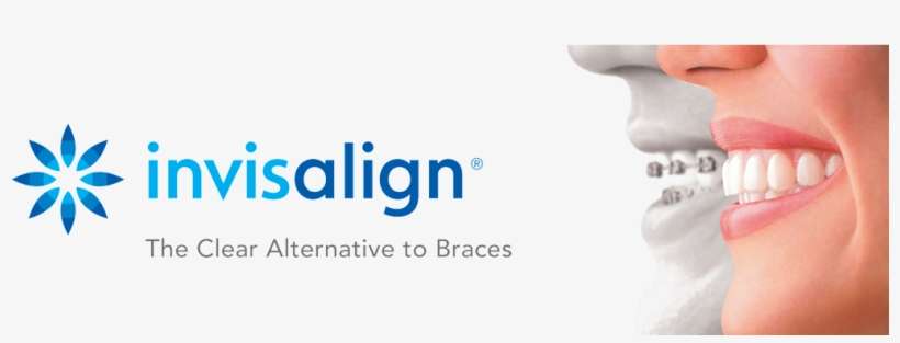 Invisalign® Takes A Modern Approach To Straightening - Invisalign The Clear Alternative To Braces, transparent png download