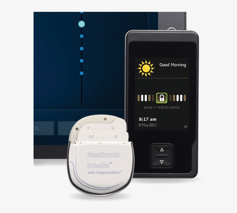 Medtronic Announces Fda Approval And U - Medtronics Spinal Cord Stimulator, transparent png download