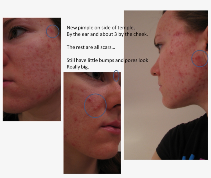 Picture12 - Freckle, transparent png download