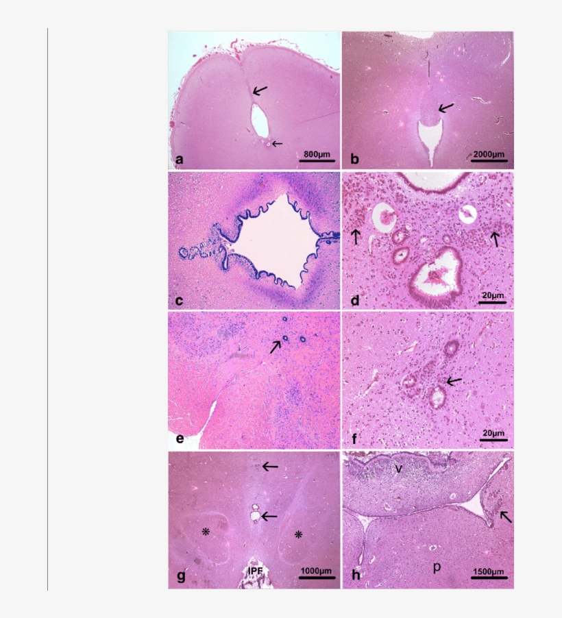 Main Histological Lesions Consisted In Hypoplasia Of - Illustration, transparent png download