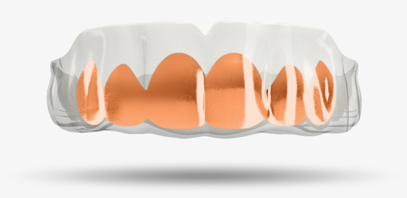 Chrome Rose Gold Grill - Gold Grill Transparent, transparent png download