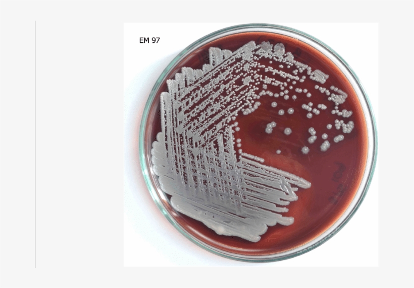 Pseudomallei Cultured In Blood Agar - Juice, transparent png download