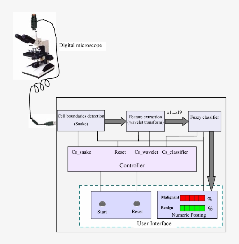 Interface Of Global Circuit Of Breast Cancer Diagnosis - Breast Cancer, transparent png download