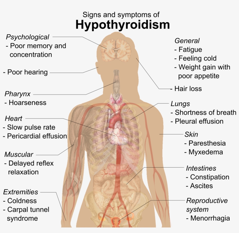 Signs And Symptoms O - Signs And Symptoms Of Hypothyroidism, transparent png download