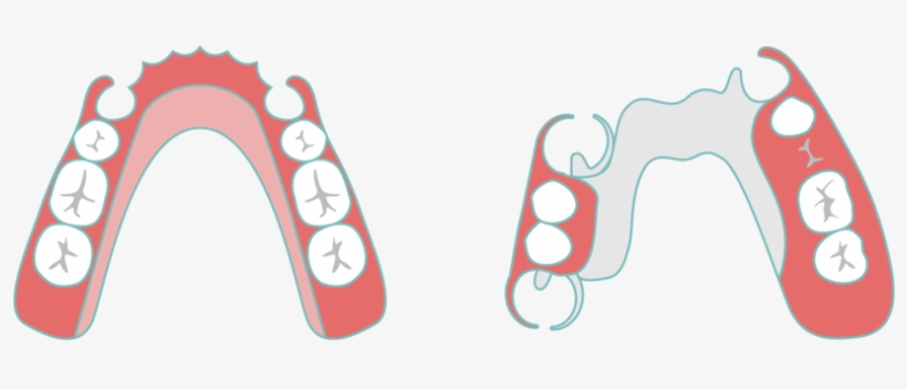 Partial Denture Sudbury Smiles - Greater Sudbury, transparent png download