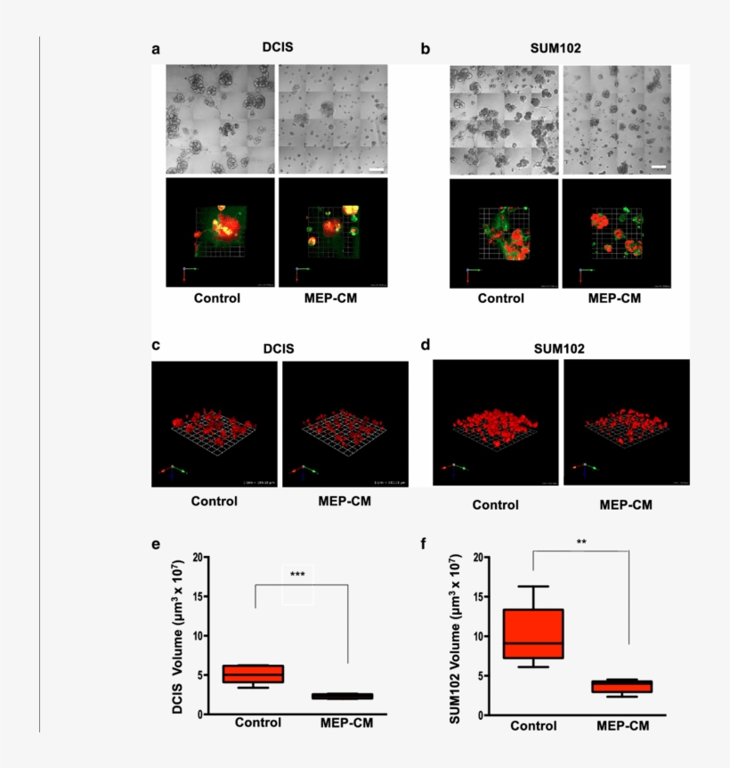 Formed In Mammary Architecture And Microenvironment - Ductal Carcinoma In Situ, transparent png download