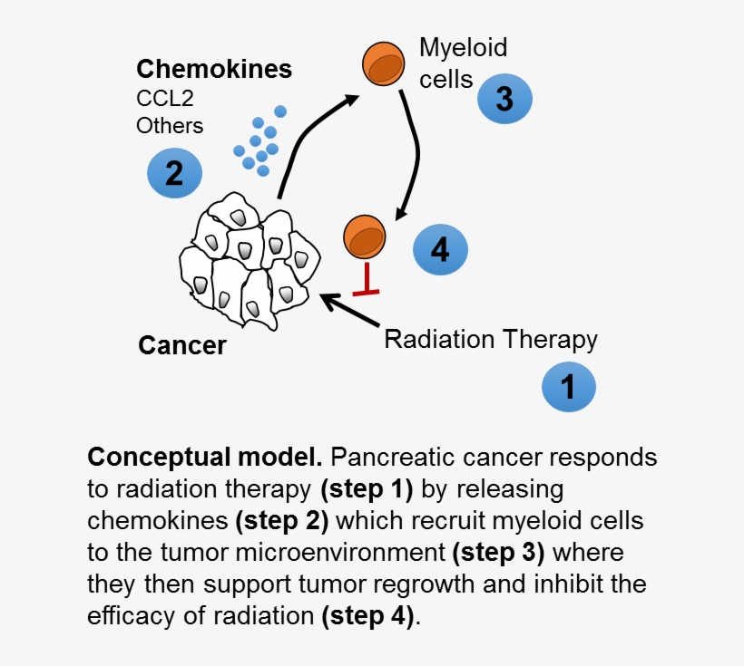 Penn Researchers Help Unravel Mysteries Of Pancreatic - Ccr2 Inhibitor Pancreatic Cancer, transparent png download
