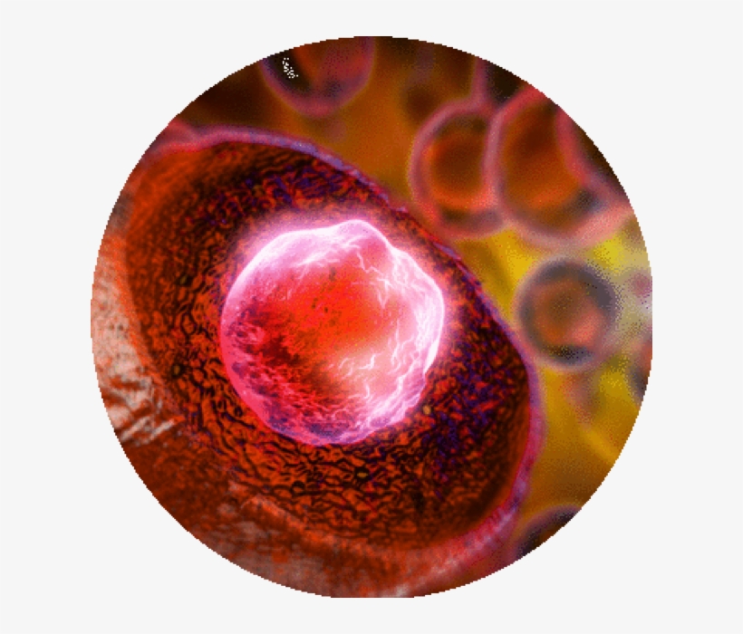 Low Risk Myelofibrosis Or High Risk Essential Thrombocythemia - Circle, transparent png download