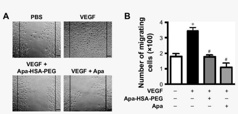 Apa Hsa Peg Nanoparticles Inhibit Vegf Induced Wounding - Cat Liver, transparent png download