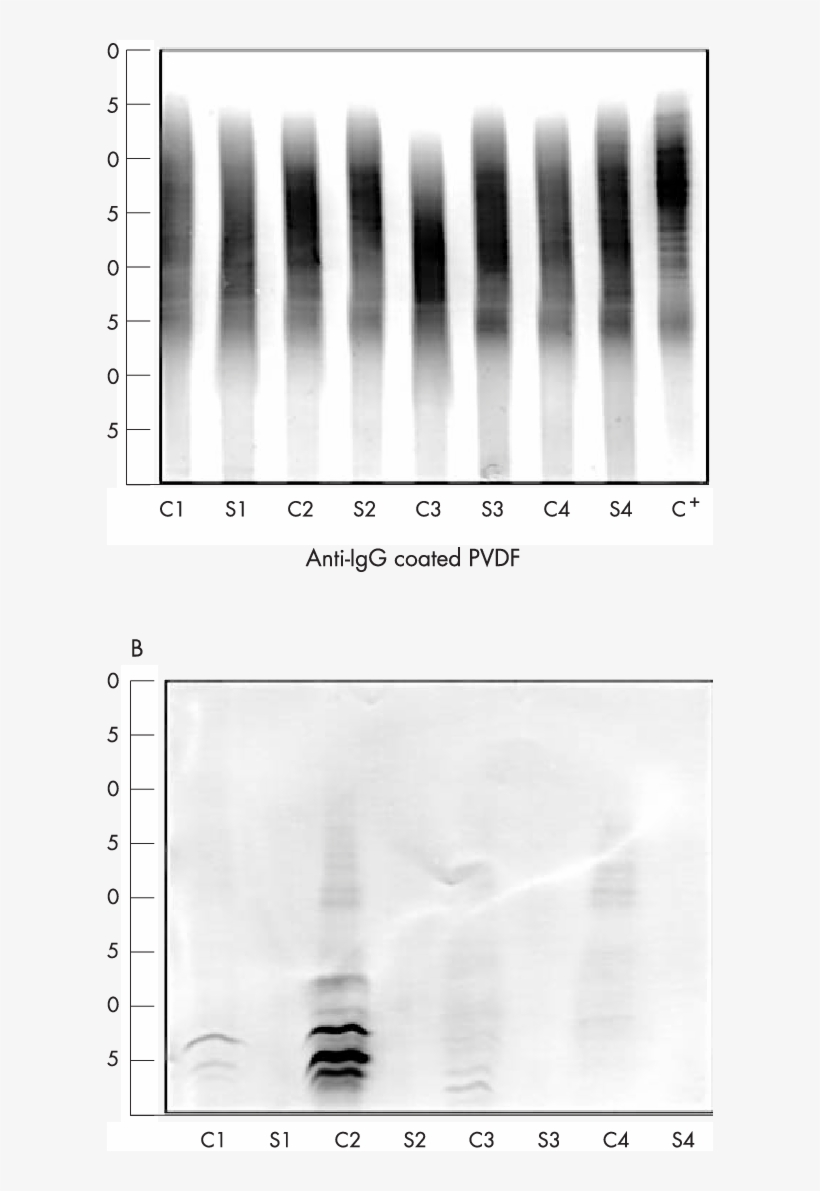 Immunoblots Of Igg And Of Free Kappa Bands (b) From - Monochrome, transparent png download