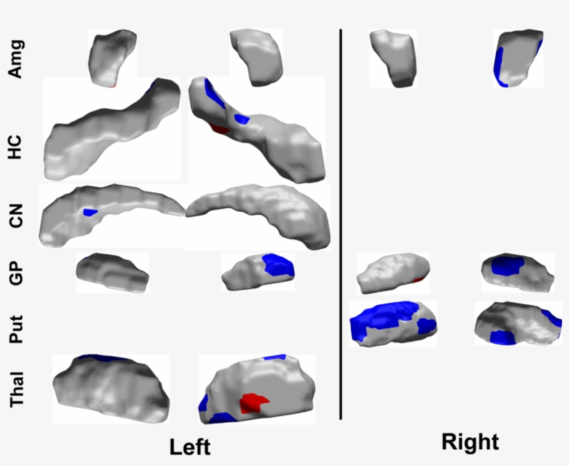 Adhd Just Image Base - Elbow Pad, transparent png download