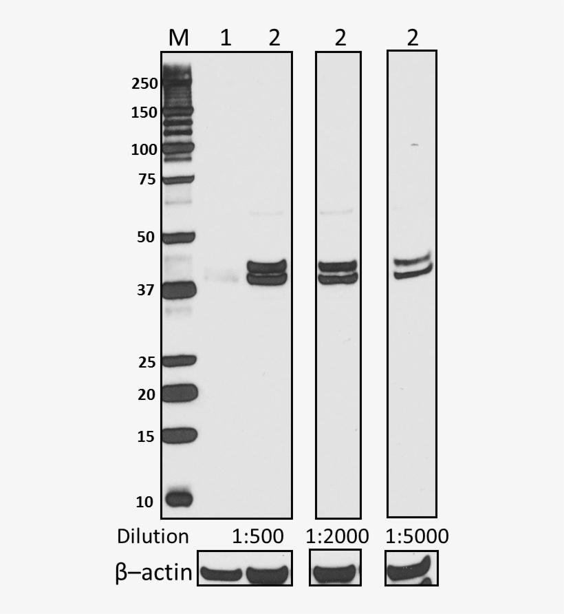 Purified Anti-erk1/2 Phospho Antibody - Tool, transparent png download