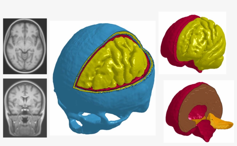This Project Will Adapt A State Of The Art Head Model - Medical Imaging, transparent png download