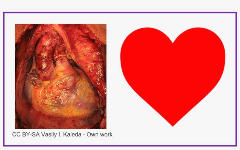 The Heart Is A Muscular Organ, Working Constantly To - Does A Heart Look Like, transparent png download