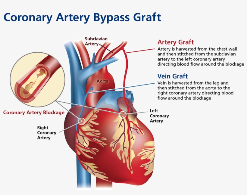 Sign Up To Join The Conversation - Diagram, transparent png download