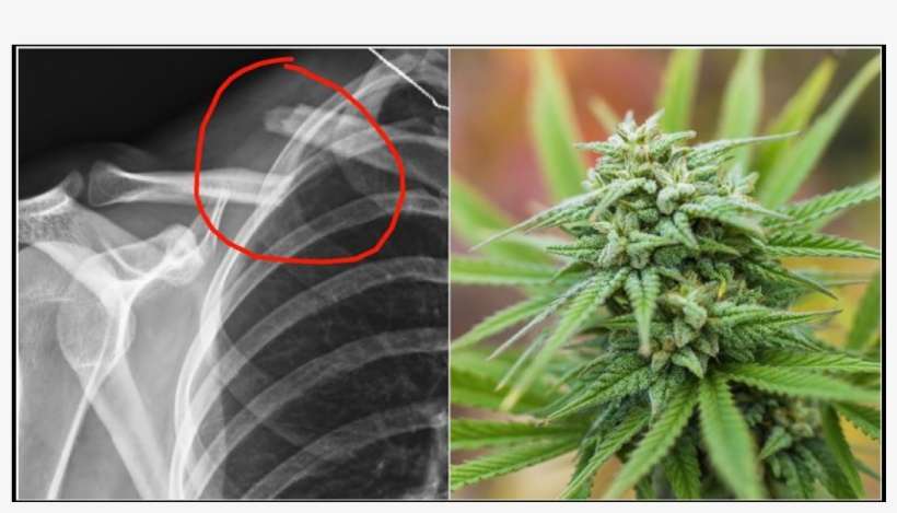 Who'd Of Thought That Smoking A Joint Could Be A Remedy - Marijuana Plants Up Close, transparent png download