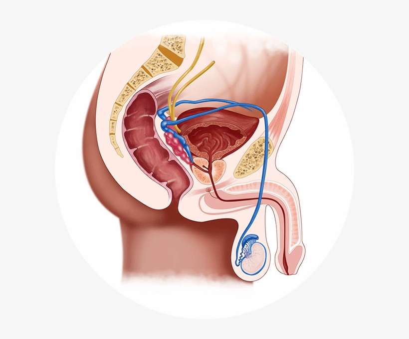 What Are The Causes Of Penile Pain - Acupuncture For Premature Ejaculation, transparent png download