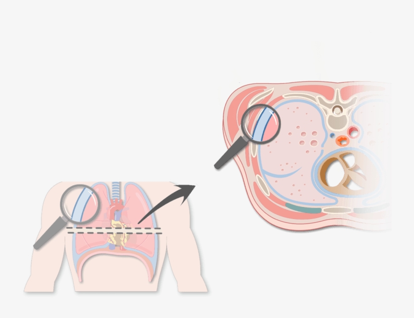 An Expanded View Of The Thorax Magnifying The Pleura - Pleurae And Pleural Cavities, transparent png download
