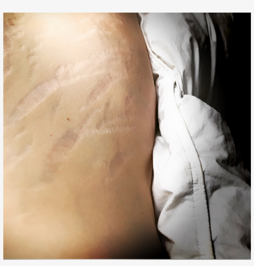 These Are My Tiger Stripes I've Had Them Since I Had - Canyon, transparent png download