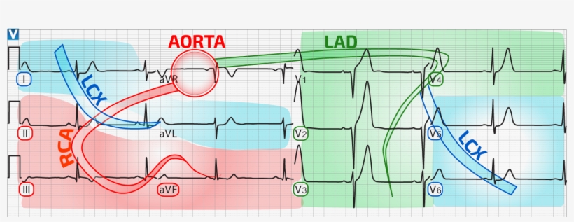 Distribution Of Coronary Perfusion And The Ecg - Ecg Coronary Arteries, transparent png download