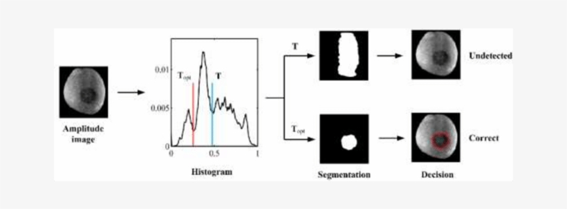 Schematic Of Bruise Segmentation By The Threshold Obtained - Diagram, transparent png download
