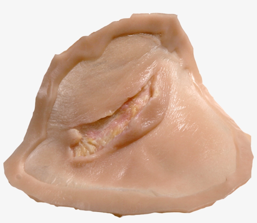 Drawing Blood Bruising - Scar, transparent png download