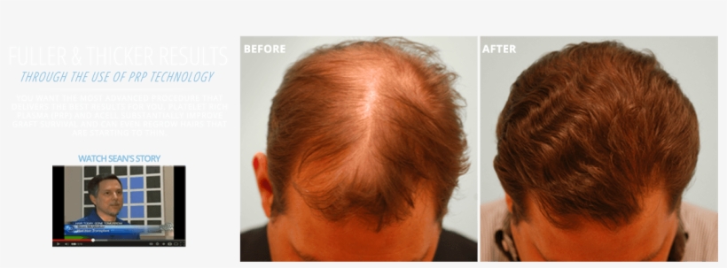 Making A Difference - Red Hair, transparent png download