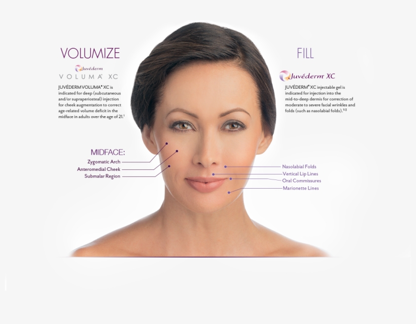 How Png Bruise Juvederm - Freckle, transparent png download