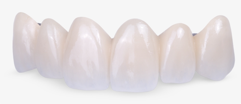 Fused To Metal - Oval, transparent png download