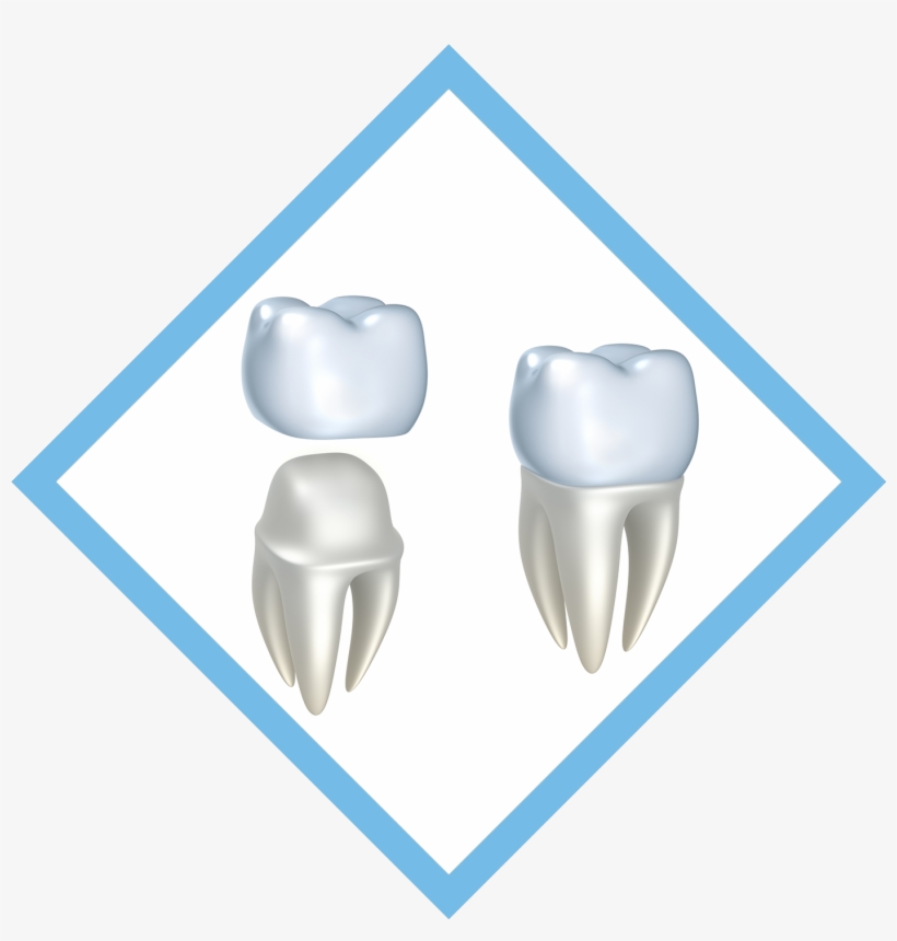 Ceramic Crown, transparent png download