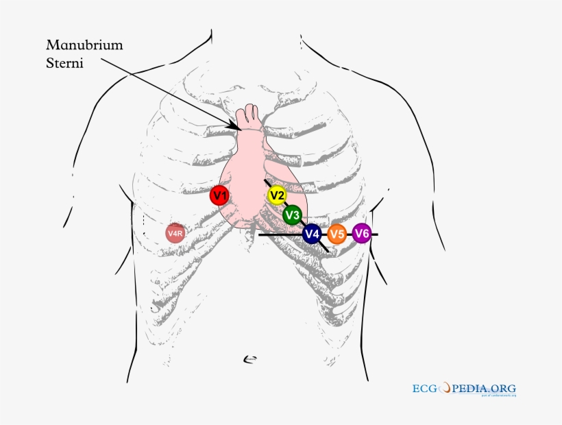 Chest Leads 12 Afleidingen Ecg Plakken PNG Image Transparent PNG Free Download on SeekPNG