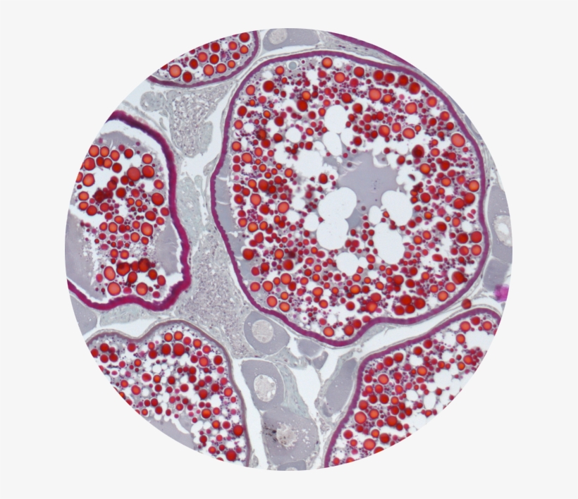 Given The Situation Of General Overexploitation Of - Circle, transparent png download