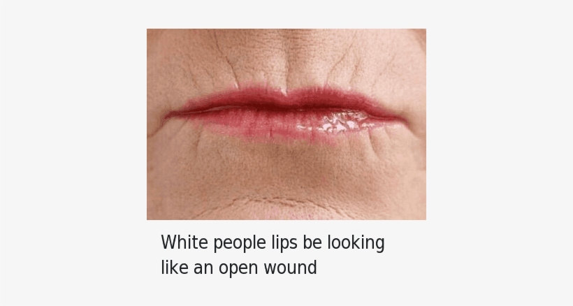 White People, White, And Ans - Lips That Look Like Open Wounds, transparent png download