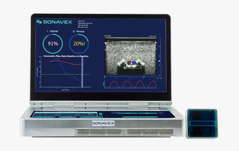 Download Sonavex Logo - Electronics, transparent png download