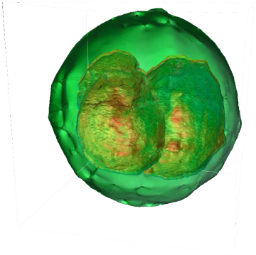 Widefield 3d Tomography - Phi Optics Inc. (400x385), Png Download