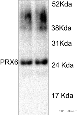 Anti-peroxiredoxin 6 Antibody - Prdx6 (306x400), Png Download