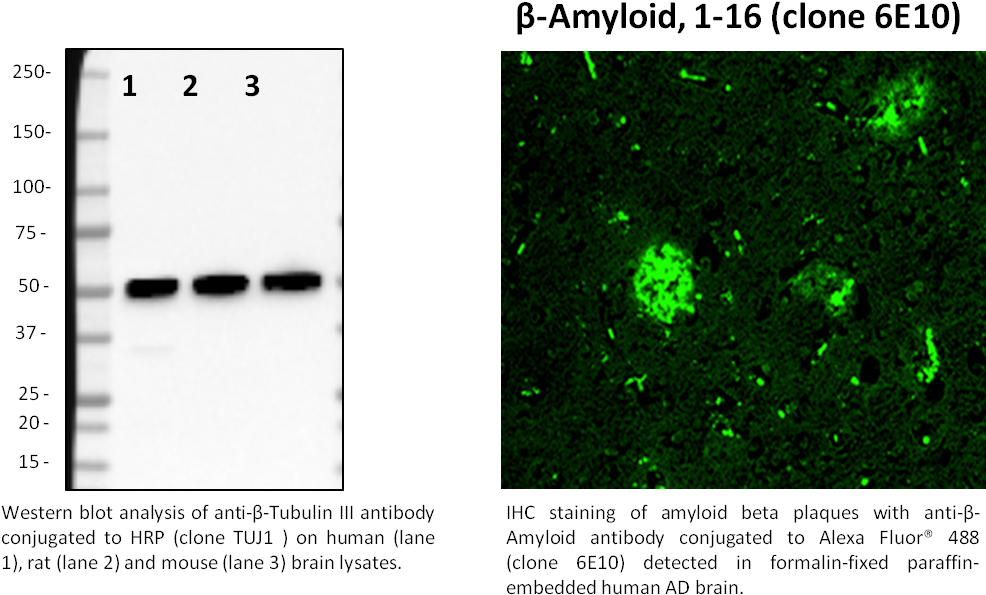 Anti Beta Amyloid 1 42 Western Blot (1010x652), Png Download