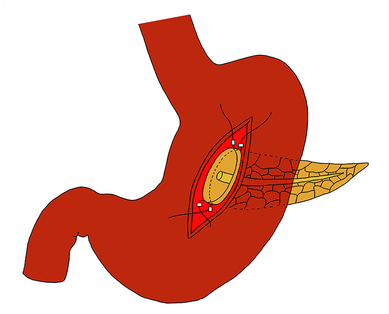 References (800x800), Png Download