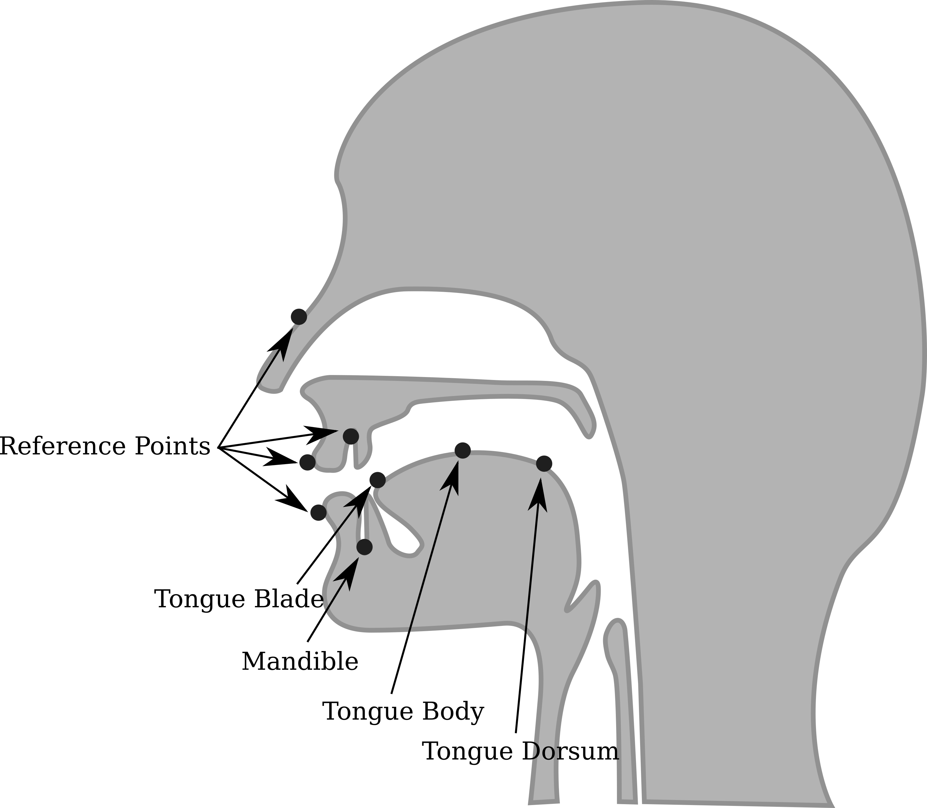 Ema Coil Placement2 - Cartoon (3131x2728), Png Download