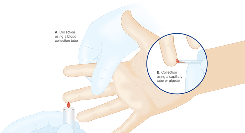 Collecting Cap Blood Sample - Vacutainer (870x595), Png Download